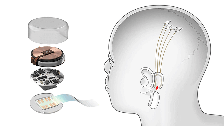 Neuralink Implanta Por Primera Vez Tecnolog A Cerebral En Un Paciente